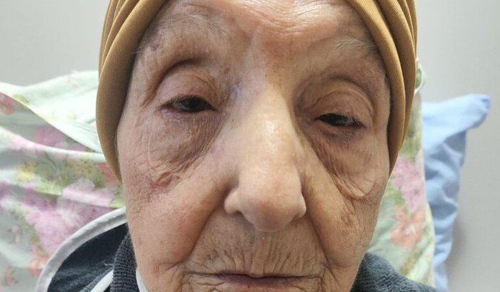 "Campanha busca apoio para garantir cuidados dignos a mãe com Alzheimer avançado"