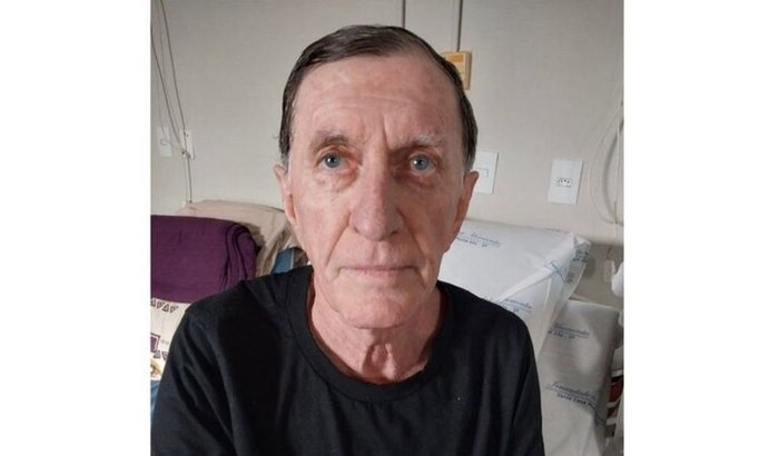 Gilberto Geromel luta contra melanoma metastático e precisa de apoio para tratamento negado pelo SUS