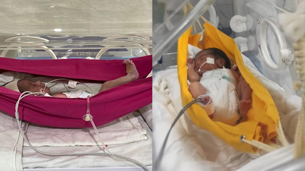 Dormir em redes melhora o desenvolvimento e ganho de peso de bebês prematuros, aponta estudo da UFC