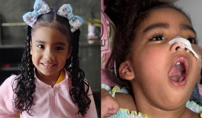 Vaquinha busca apoio para tratamento de menina que ficou com sequelas graves após gripe comum