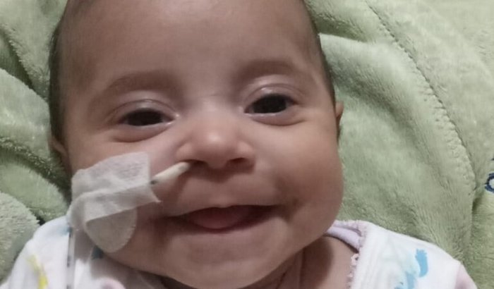"Campanha busca apoio para tratamento de bebê com grave problema cardíaco em hospital particular"