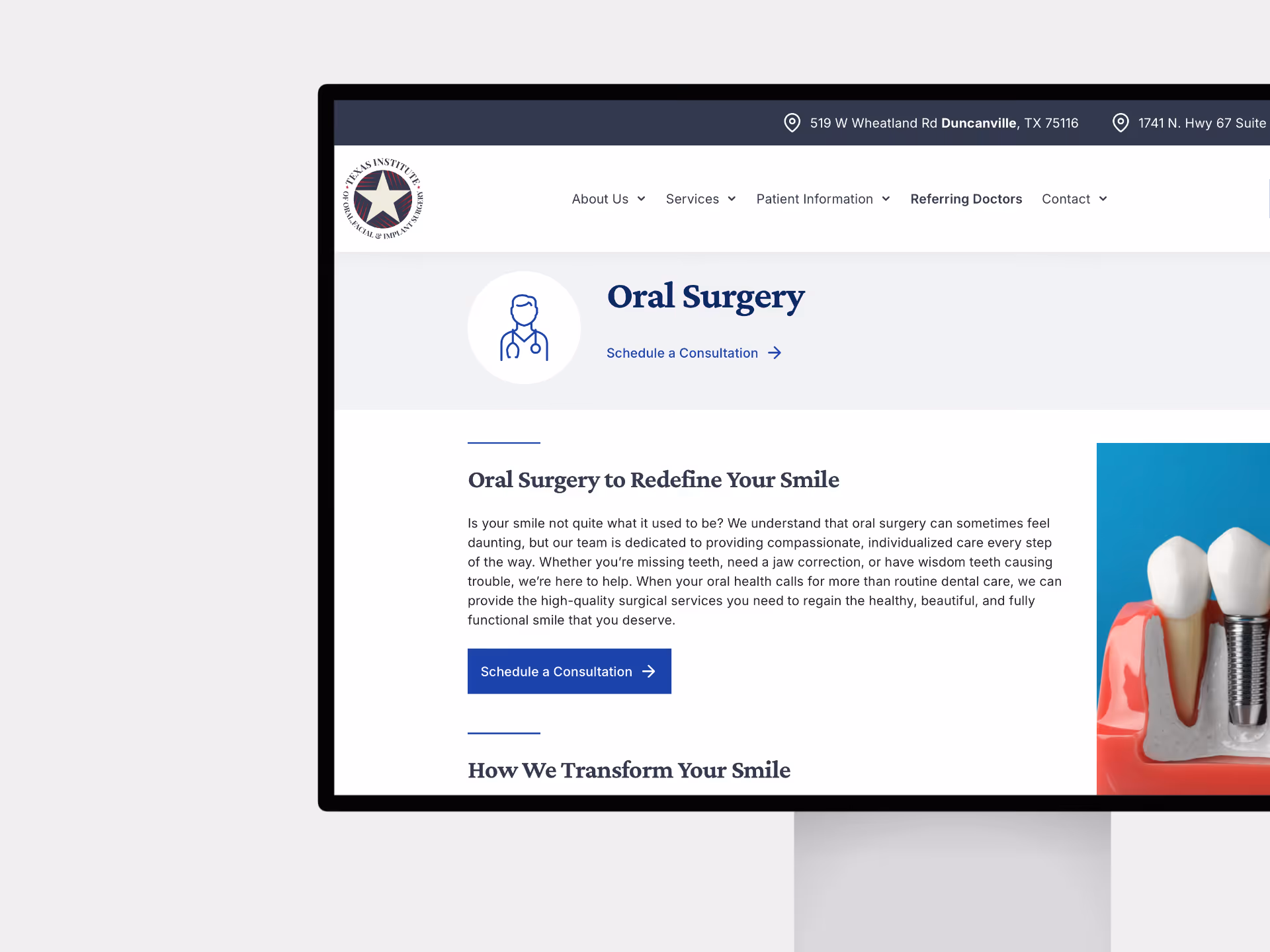 Website page for oral surgery featuring a tooth implant diagram and options to schedule a consultation.
