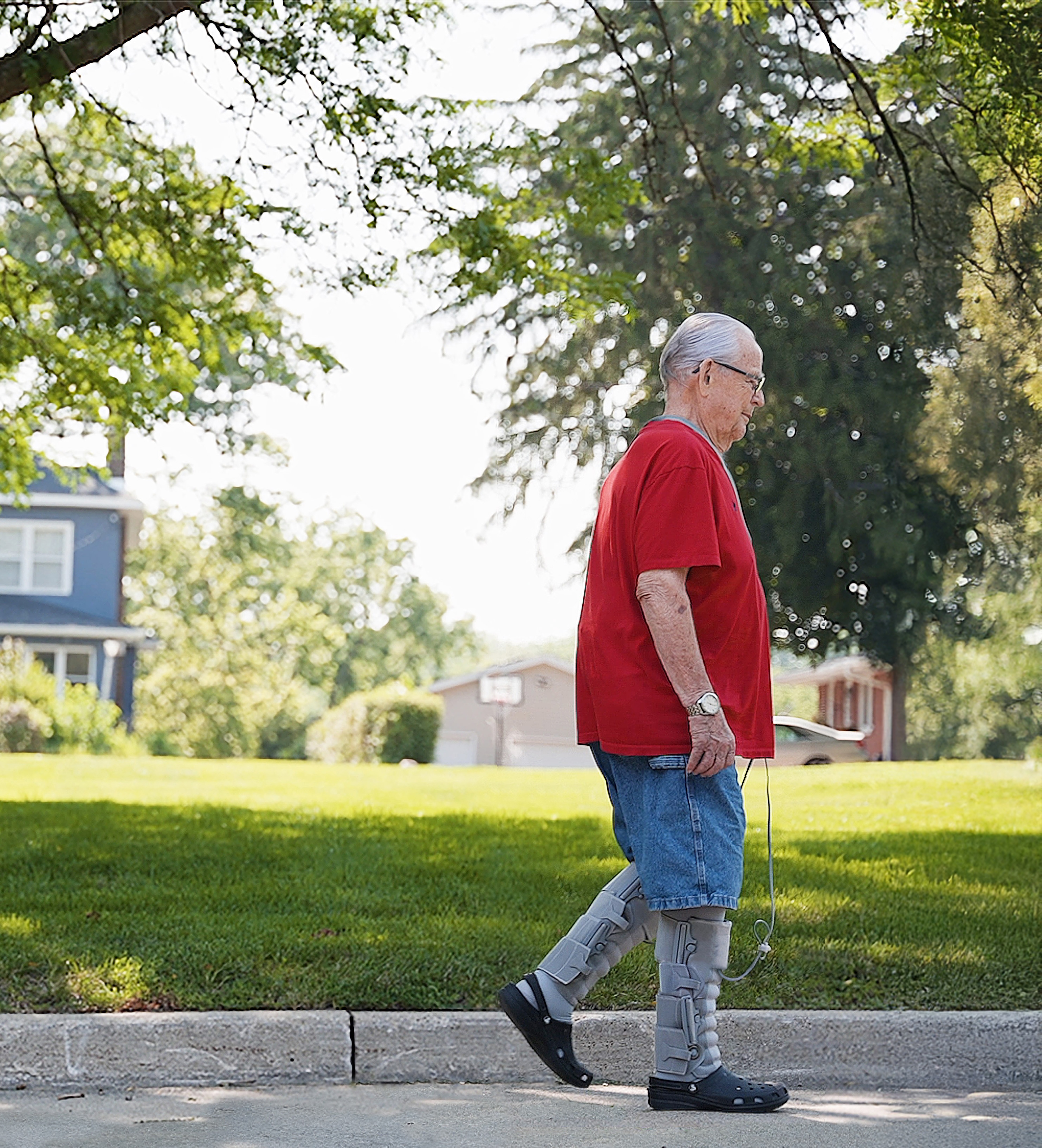 Man walking wearing Dayspring product to treat lymphedema or phlebolymphedema