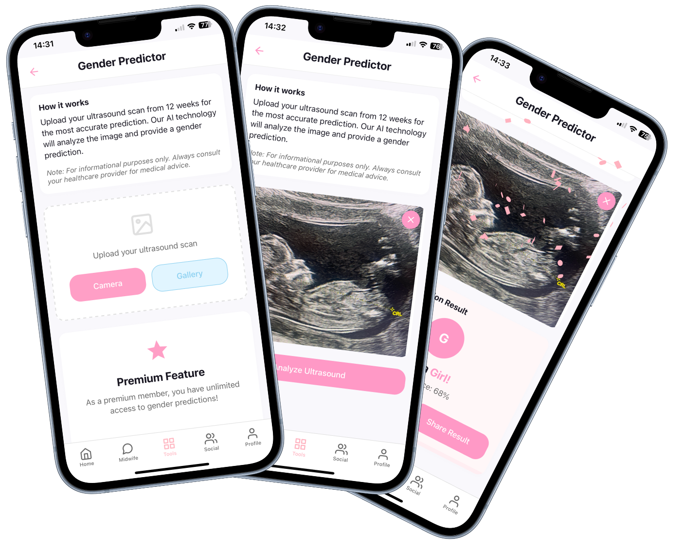Baby Gender AI predictor tool on phone. 3 screens. 