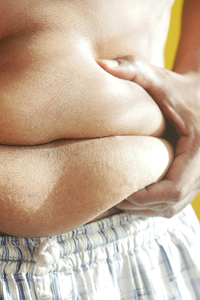 Closeup of belly fat, the focus of TruSculpt treatments