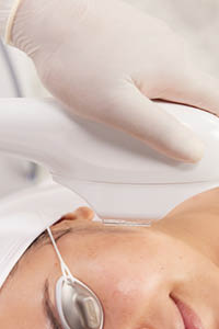 Limelight IPL hand piece held to the side of a woman's face while her eyes are covered with protective goggles