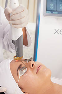 Woman with eye protection, having a laser genesis hand piece held against her forehead with the targeting laser visible. XEO+ machine in the background while the hand piece is held by a gloved hand.