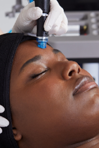 Woman receiving HydraFacial at Complexion Medspa Cobourg