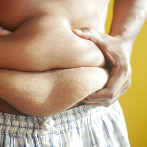 Person pinching excess abdominal fat wearing checkered shorts.