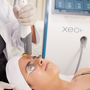 Woman receiving laser skin treatment on forehead using a Xeomin laser device.