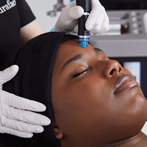 Close-up of a person receiving a Hydrafacial treatment on the forehead by a technician wearing white gloves.
