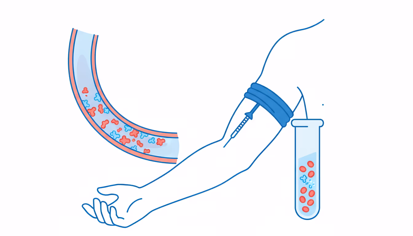 C-Reactive Protein Test (CRP)