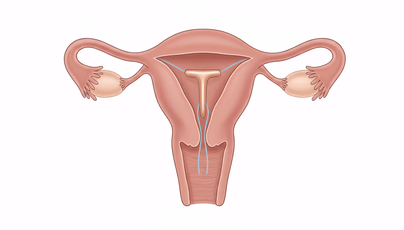 Contraceptive device, intrauterine (IUD)