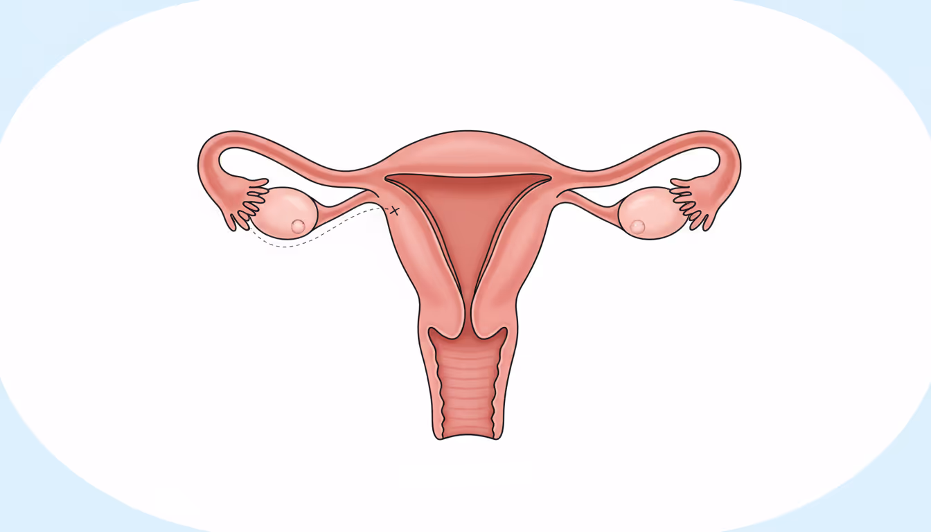 Extrauterine pregnancy