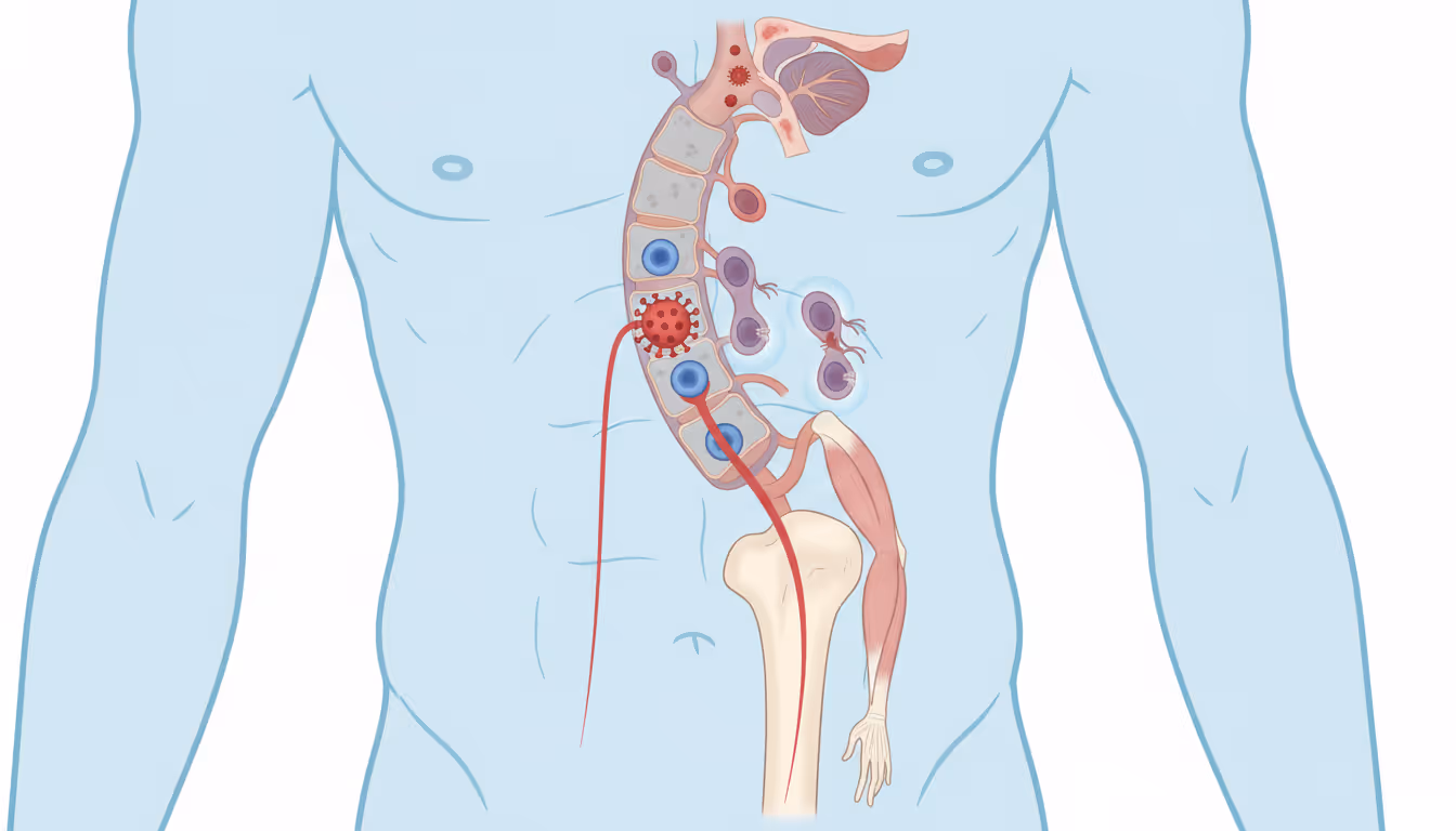 Infantile paralysis (polio)