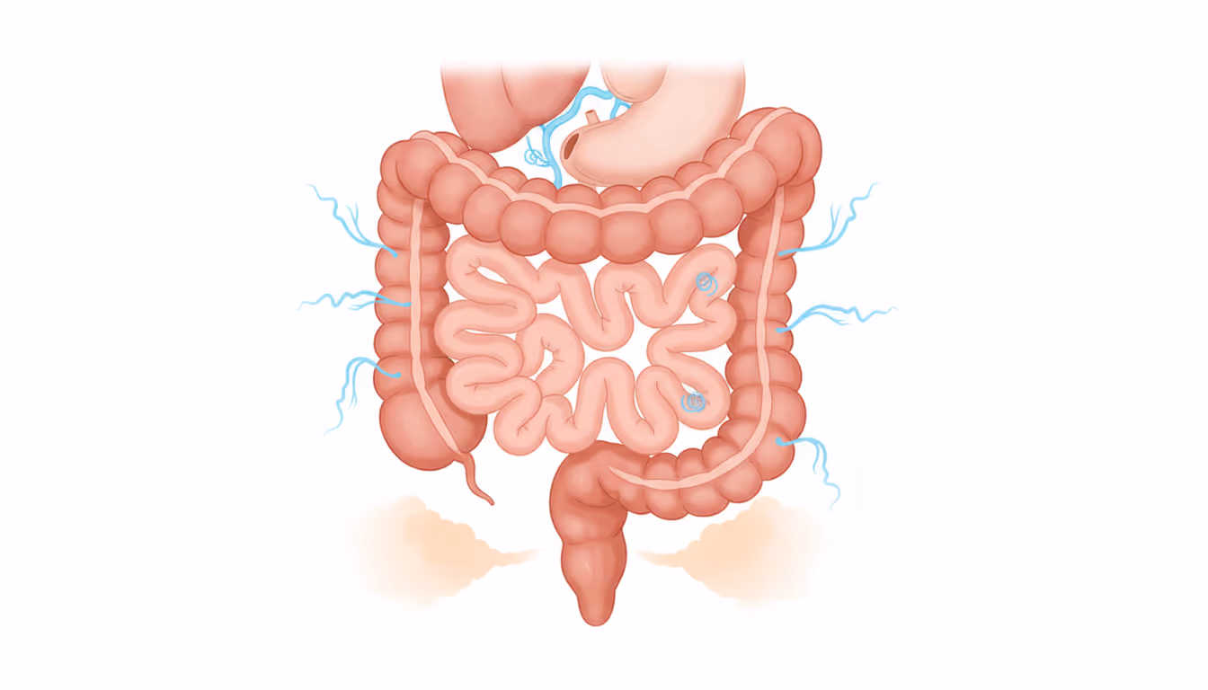 Syndrome, nervous colon