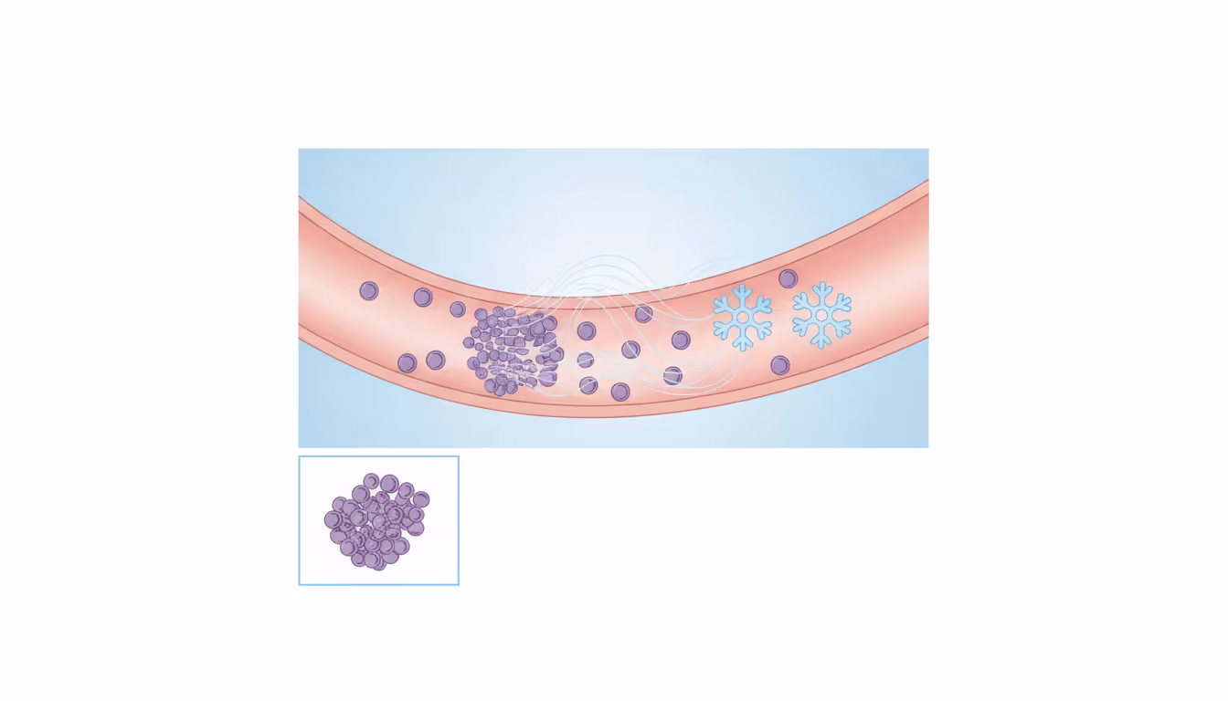 TTP (thrombotic thrombocytopenic purpura)