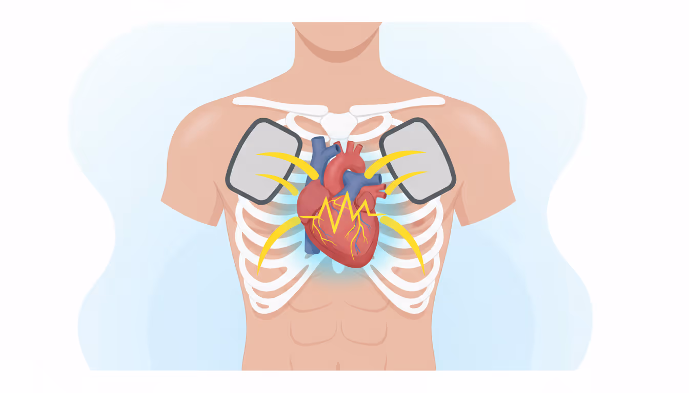 Endotracheal Tube (ETT)