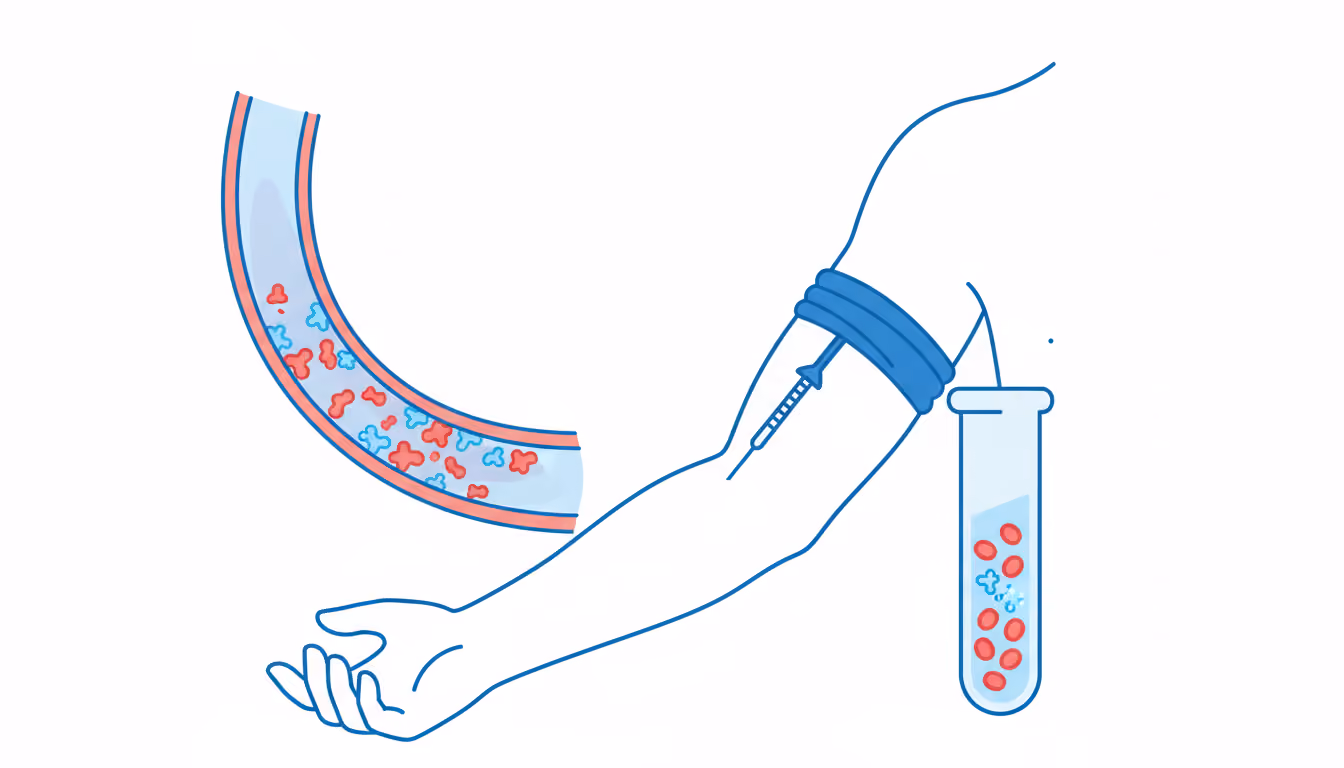 C-Reactive Protein Test (CRP)