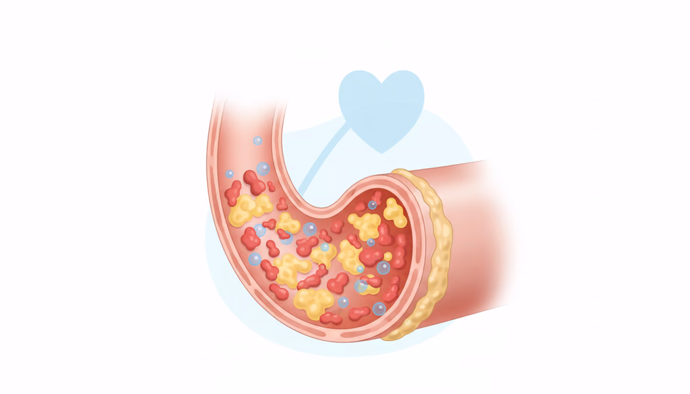 Dyslipidemia
