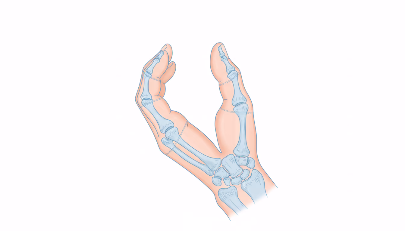 Ectrodactyly