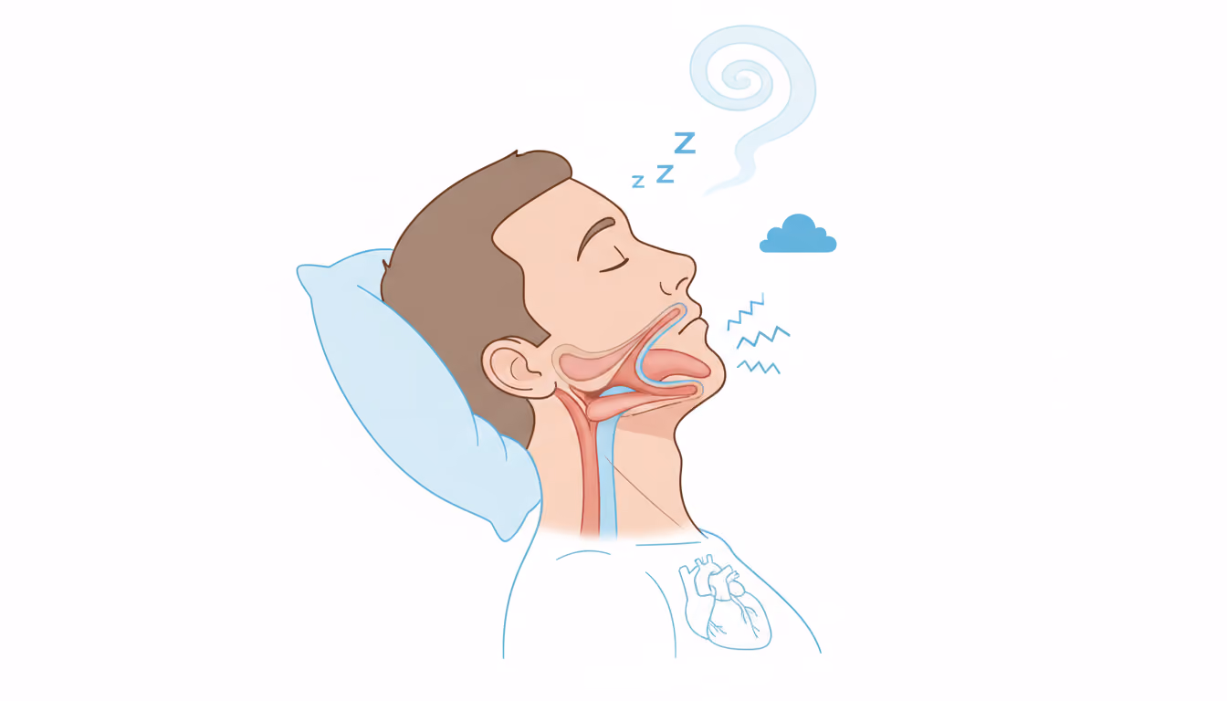 Sleep apnea