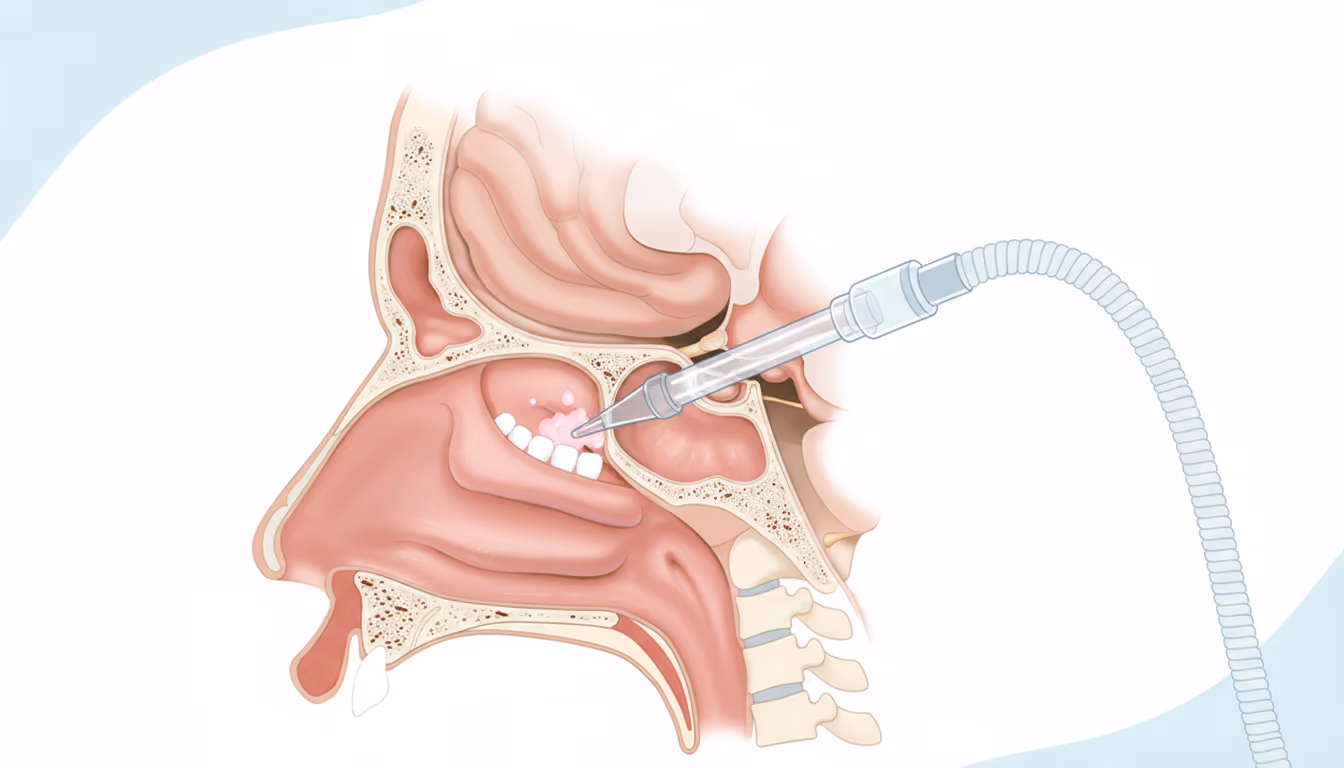Yankauer Suction