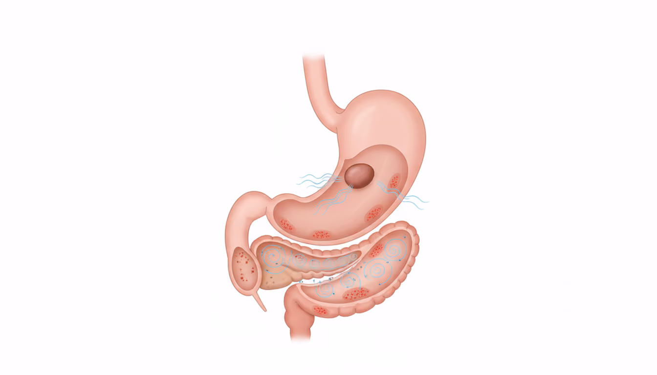 Zollinger-Ellison syndrome