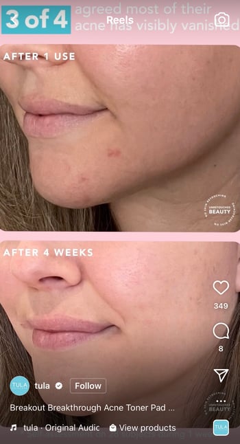 before and after content