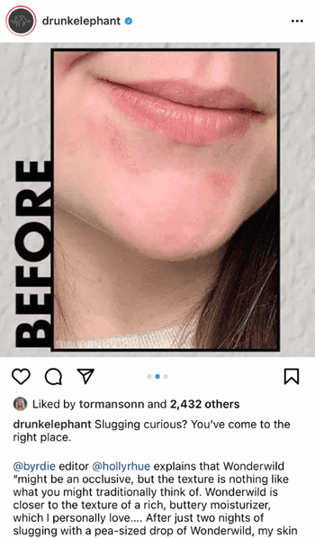 beauty before and after