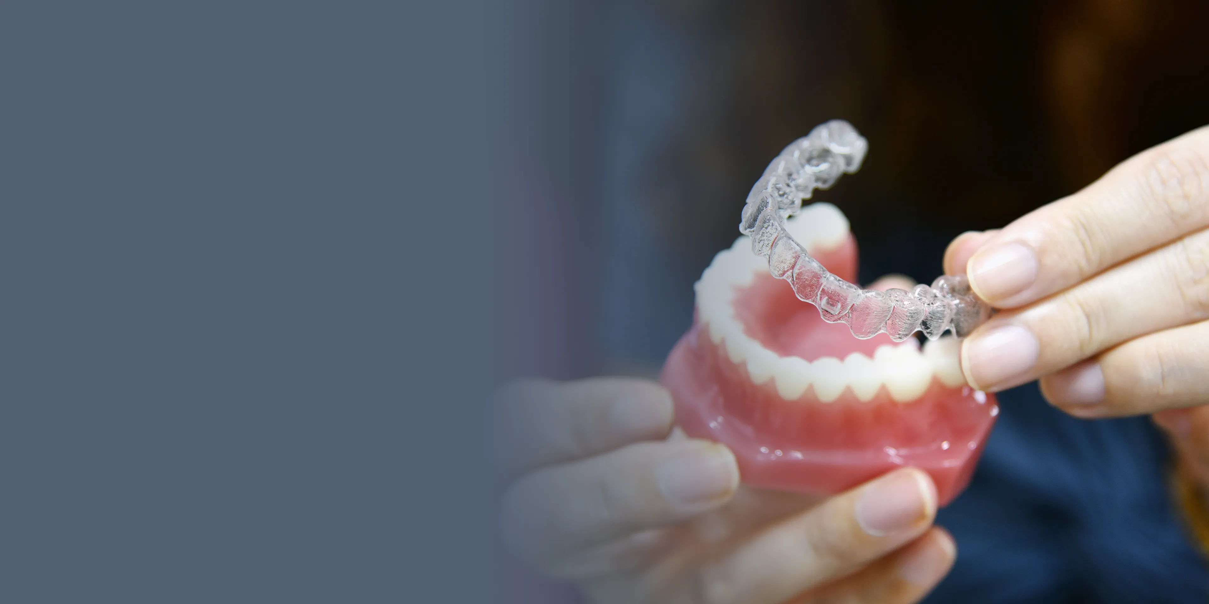 A person places a clear dental aligner onto a model of teeth.