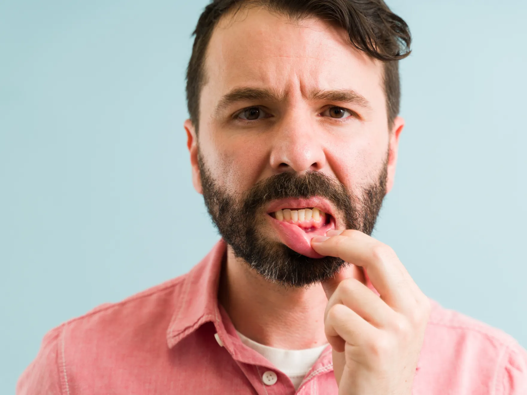 A man lifts his lip with his finger to show his teeth or gums.