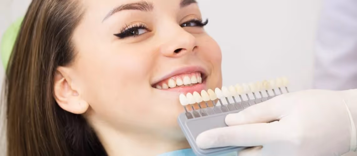 How Much Do Veneers Generally Cost?