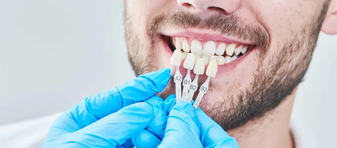What Are The Risks Involved With Getting Dental Veneers