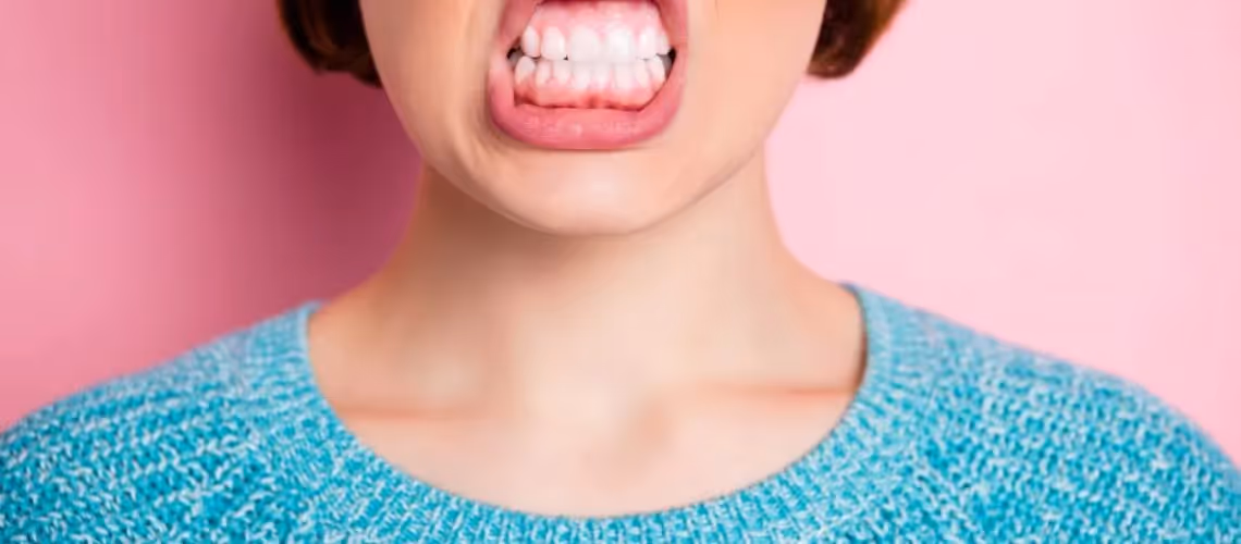 Is Gum Disease Over if Bleeding Gums Stop?