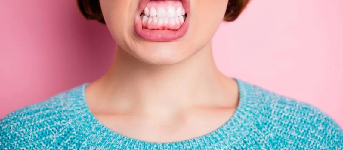 Is Gum Disease Over if Bleeding Gums Stop?