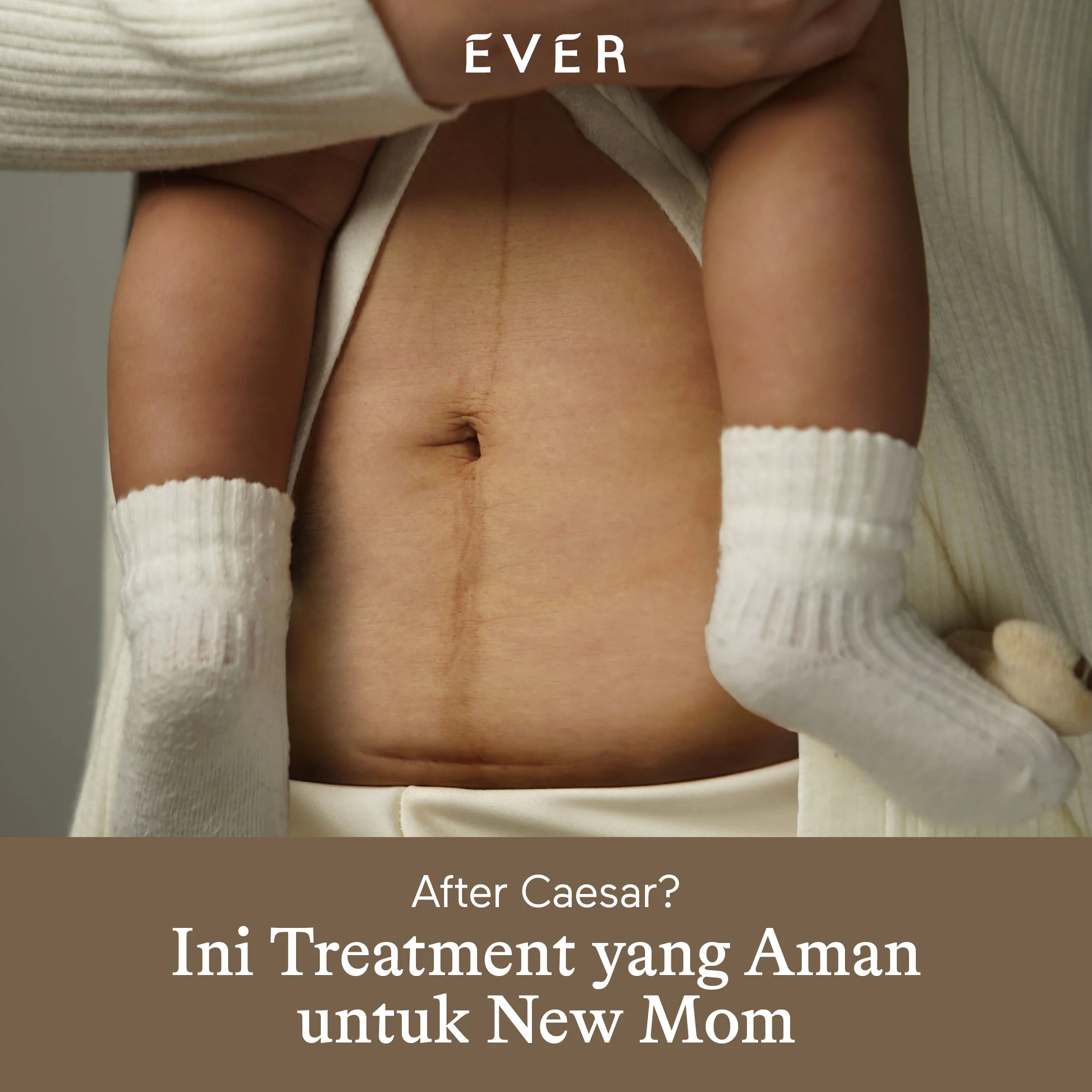 https://www.ever.co.id/post/after-caesar-ini-treatment-yang-aman-untuk-new-mom