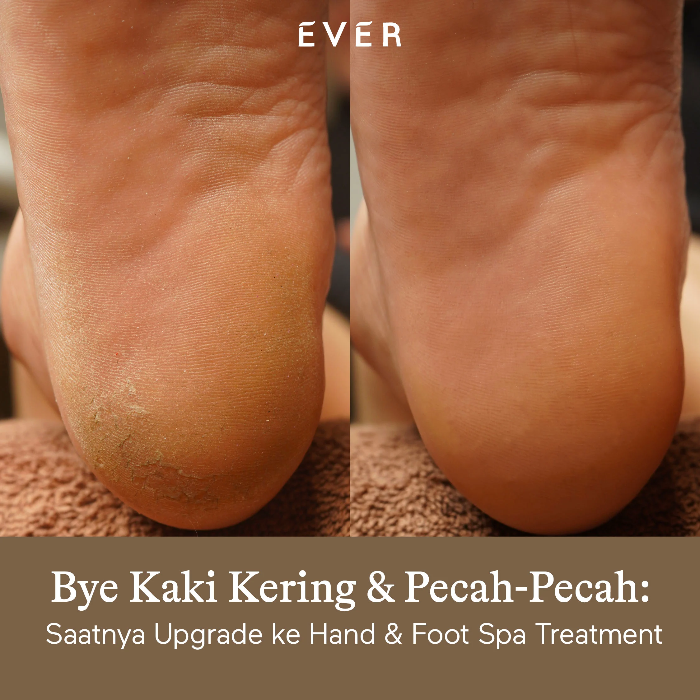 https://www.ever.co.id/post/bye-kaki-kering-pecah-pecah-saatnya-upgrade-ke-hand-foot-spa-treatment