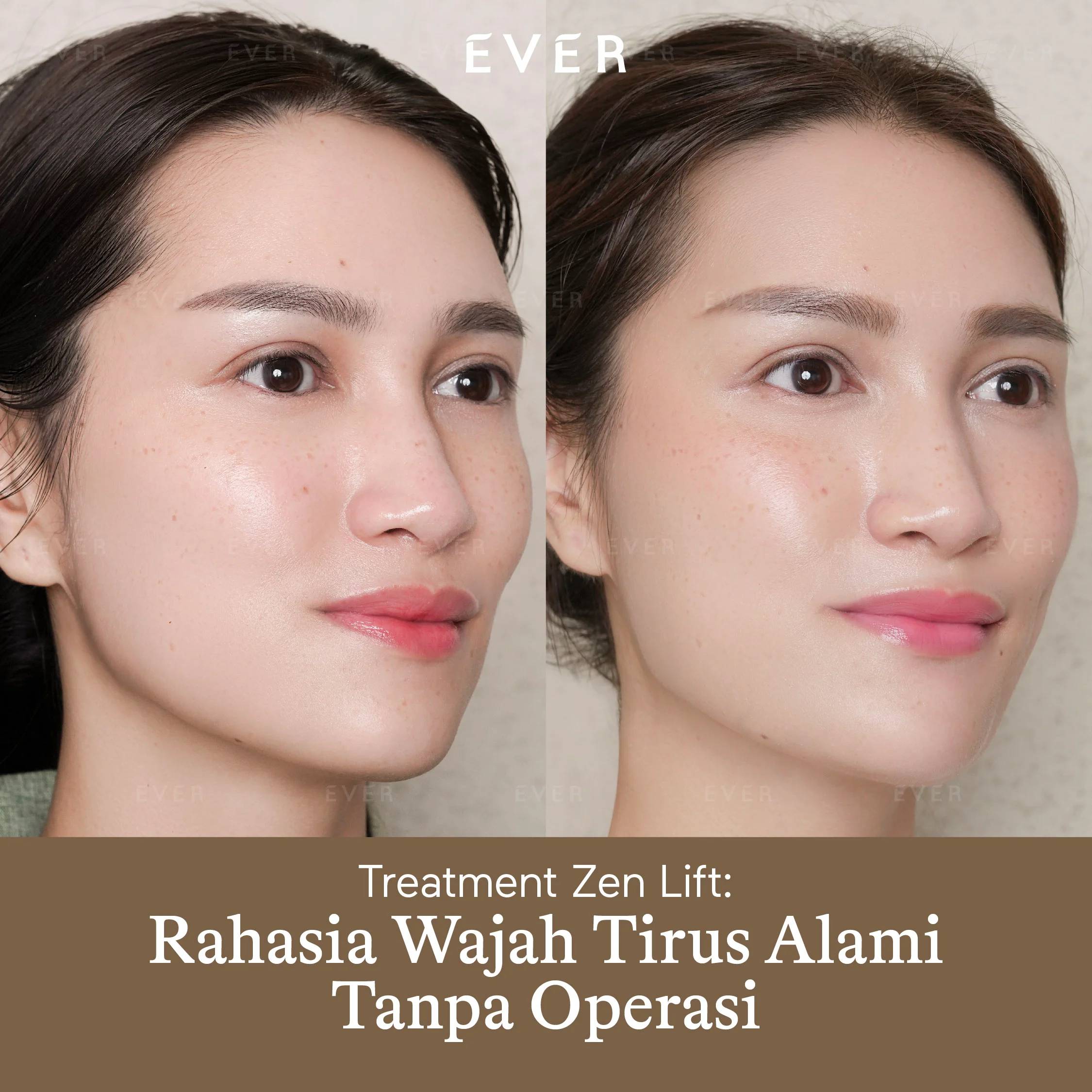 https://www.ever.co.id/post/treatment-zen-lift-rahasia-wajah-tirus-alami-tanpa-operasi