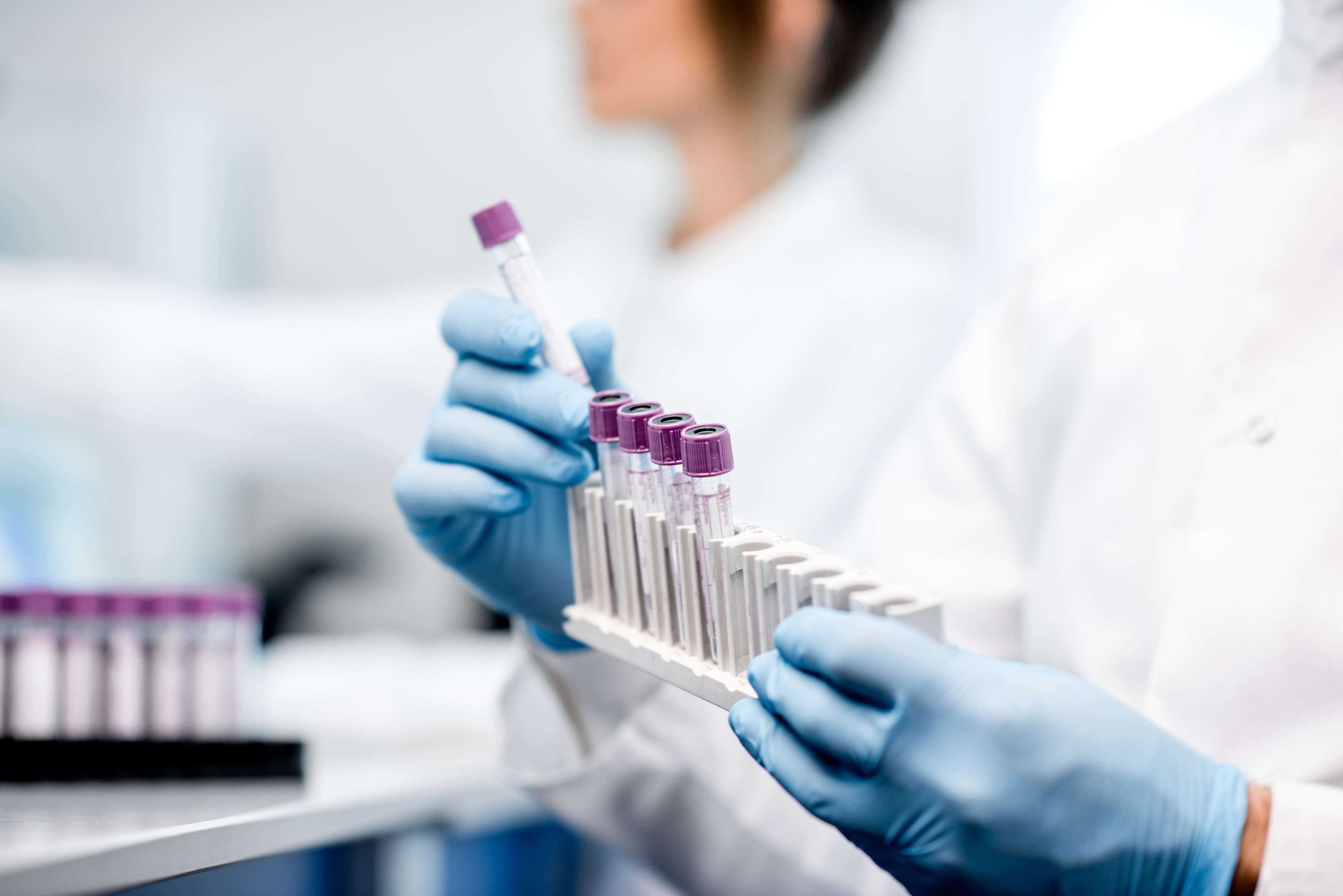 laboratory stock, sample tubes