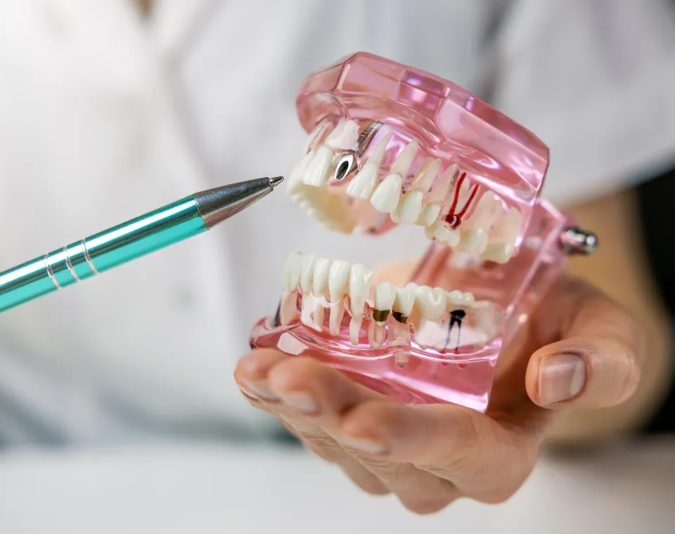 Dental Implants in Pensacola: The Ultimate Guide to Replacing Missing Teeth