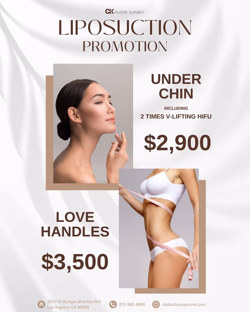 Liposuction in Los Angeles