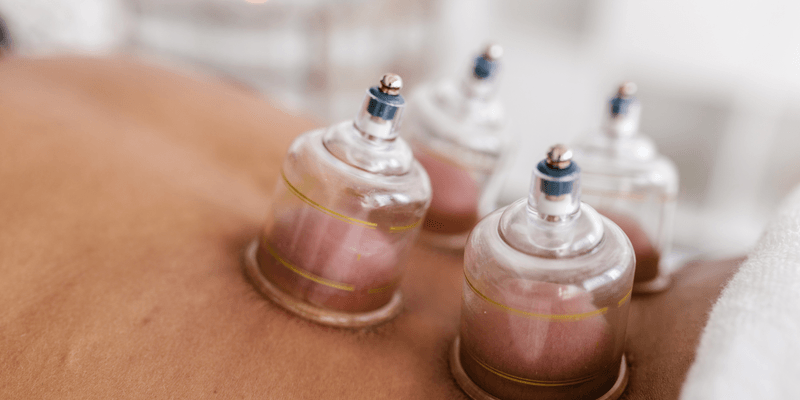 Unlocking Natural Healing: The Comprehensive Guide to Cupping Therapy