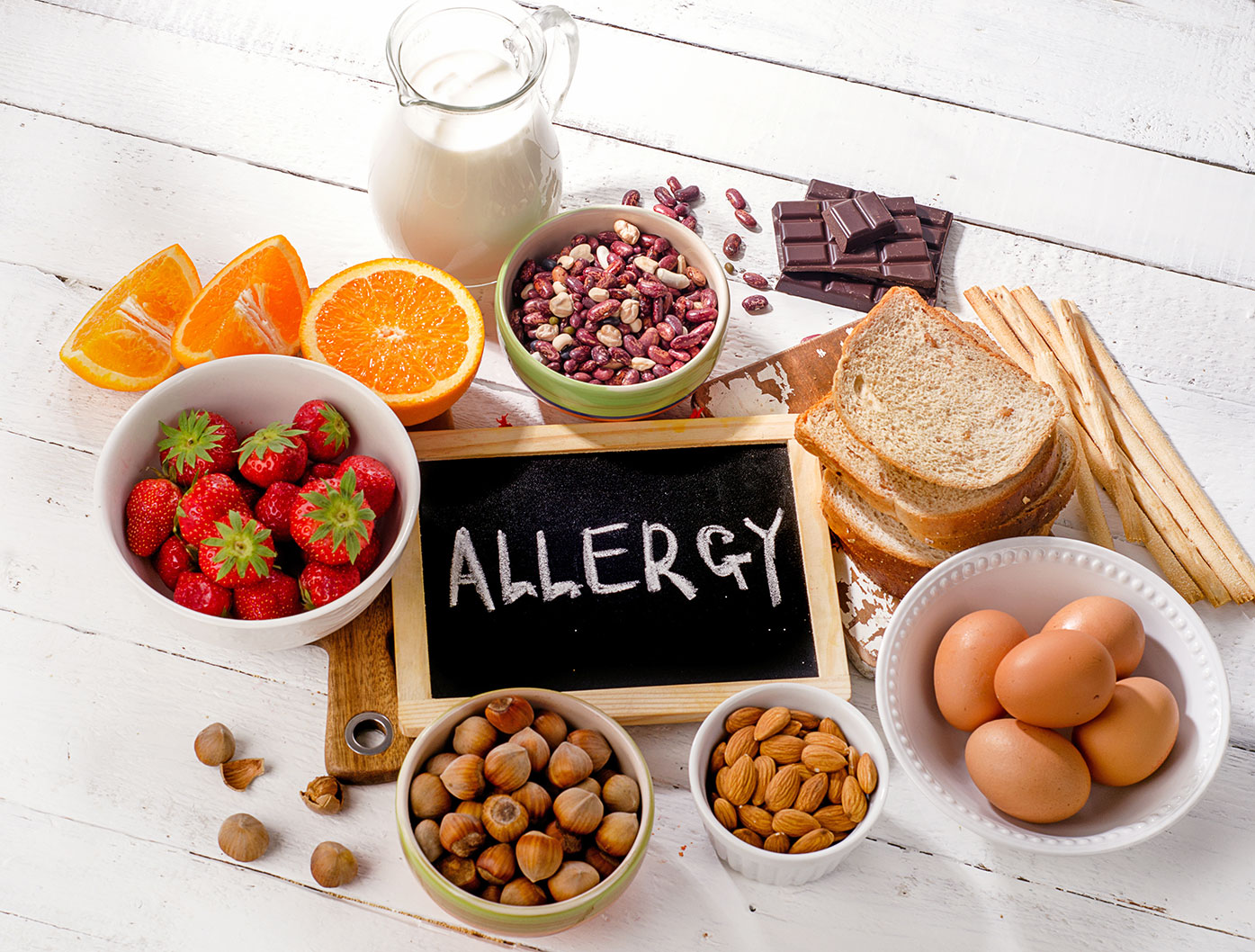 A flat lay of common food allergens - milk, bread, eggs, nuts, and strawberries, arranged around a small chalkboard labeled “Allergy.”