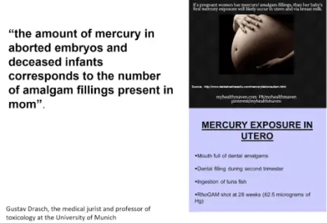 Research screenshot showing the number of aborted embryos and deceased infants corresponds to the number of amalgam fillings present in the mother
