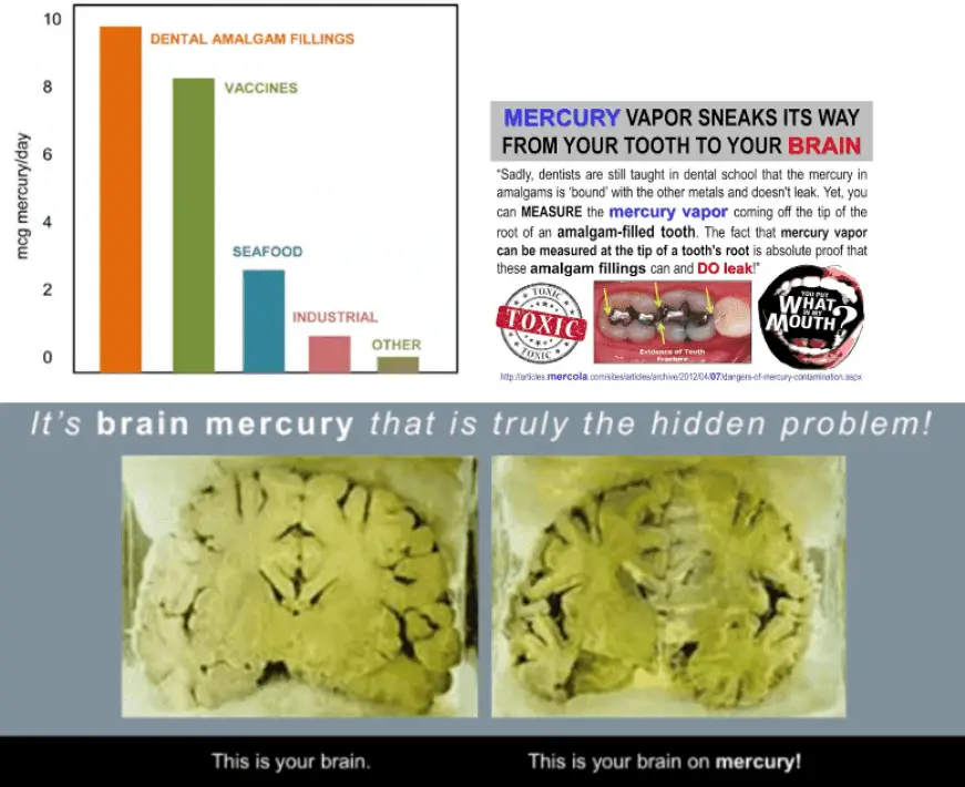 Images showing mercury in the brain