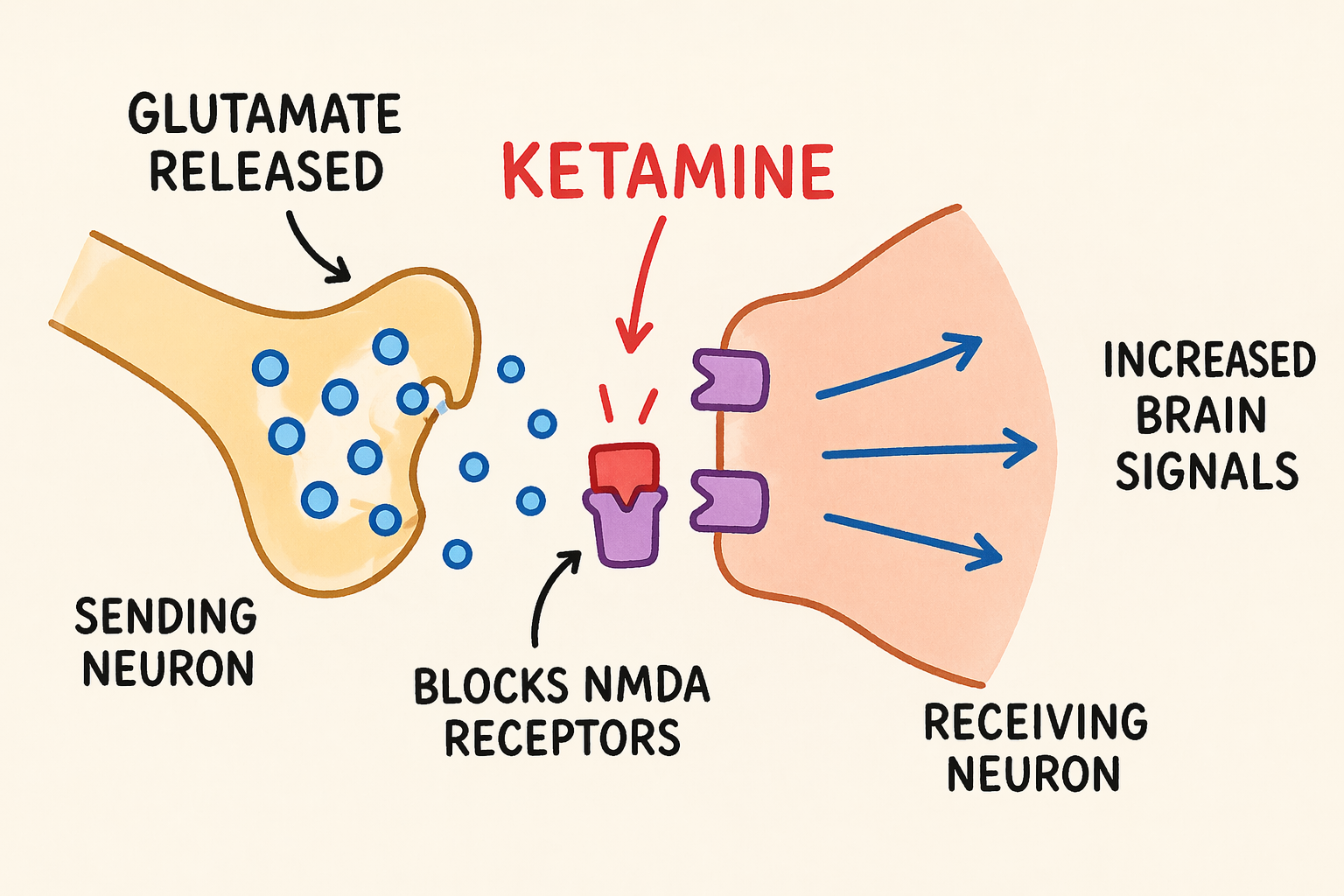 Diagram of glutamate activity in the brain with ketamine therapy