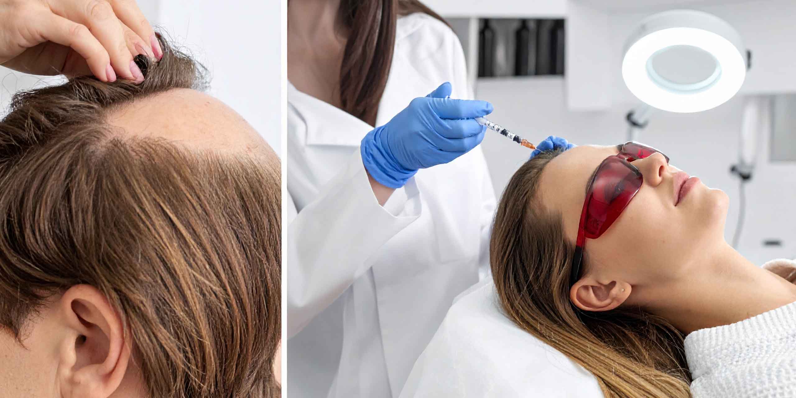 Frau liegt auf dem Rücken und bekommt eine PRP Behandlung.