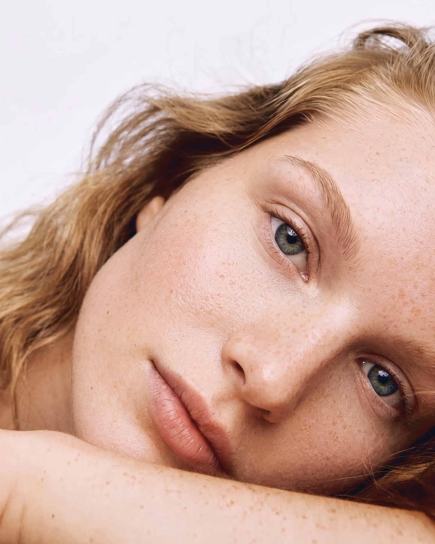 Woman with freckles resting her head on her arm