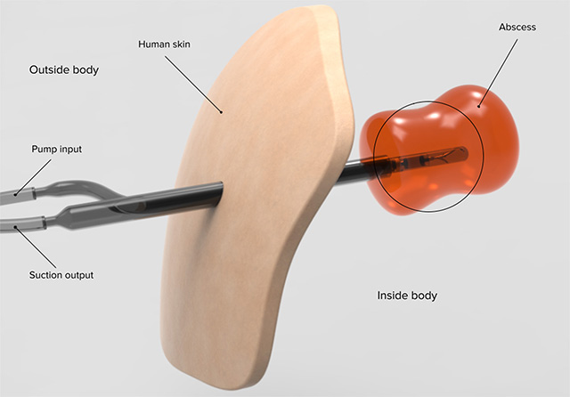 Illustration of the MADS rotating nozzle